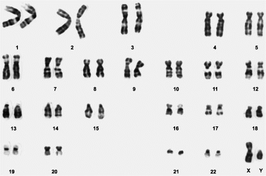 G-banded human metaphase karyotype